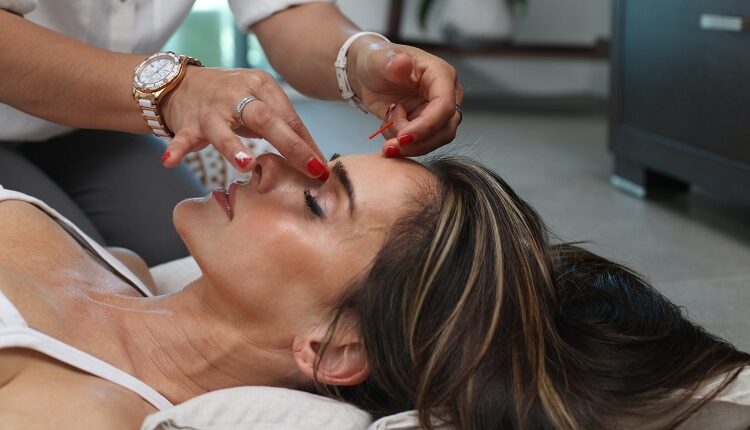 Chemical Peels