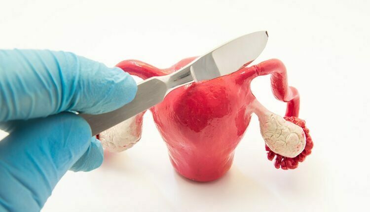 Fallopian Tubes Blockages