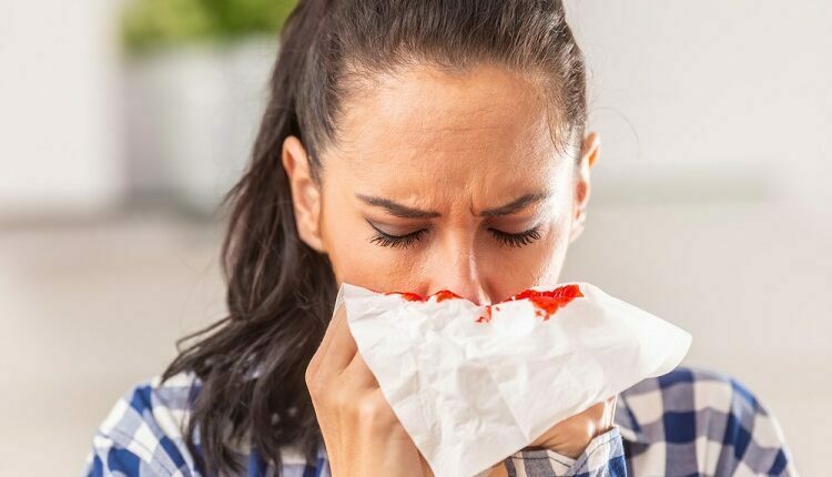 Bleeding In Women