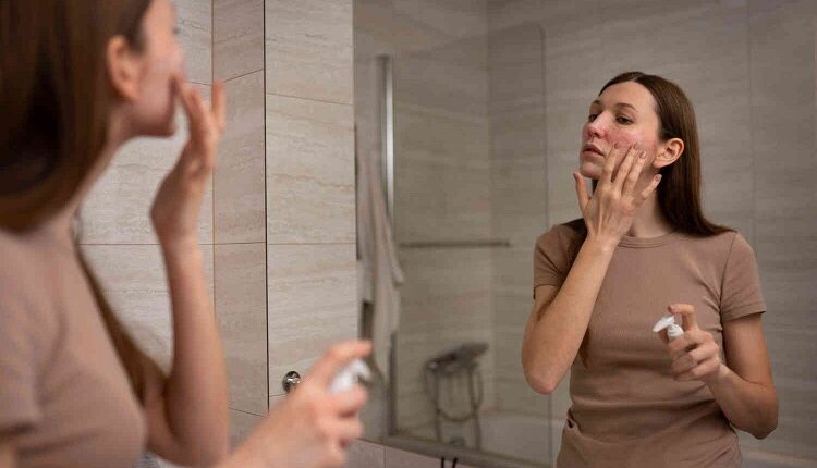 Skin Conditions